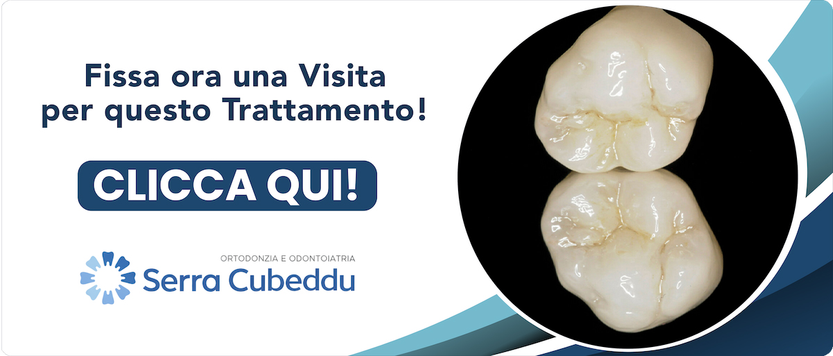 corone-in-zirconia Sassari