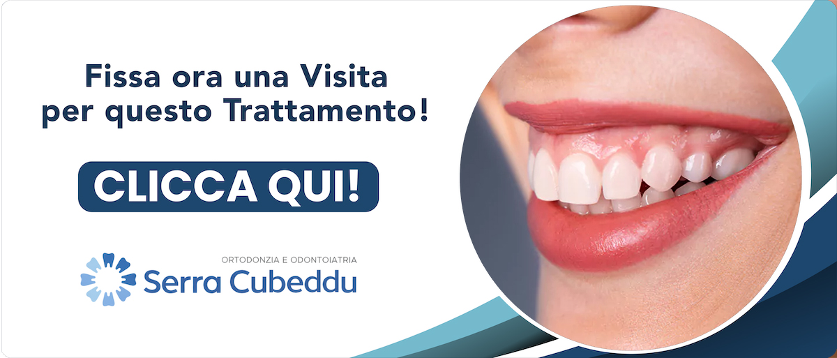 cura-del-gummy-smile Sassari