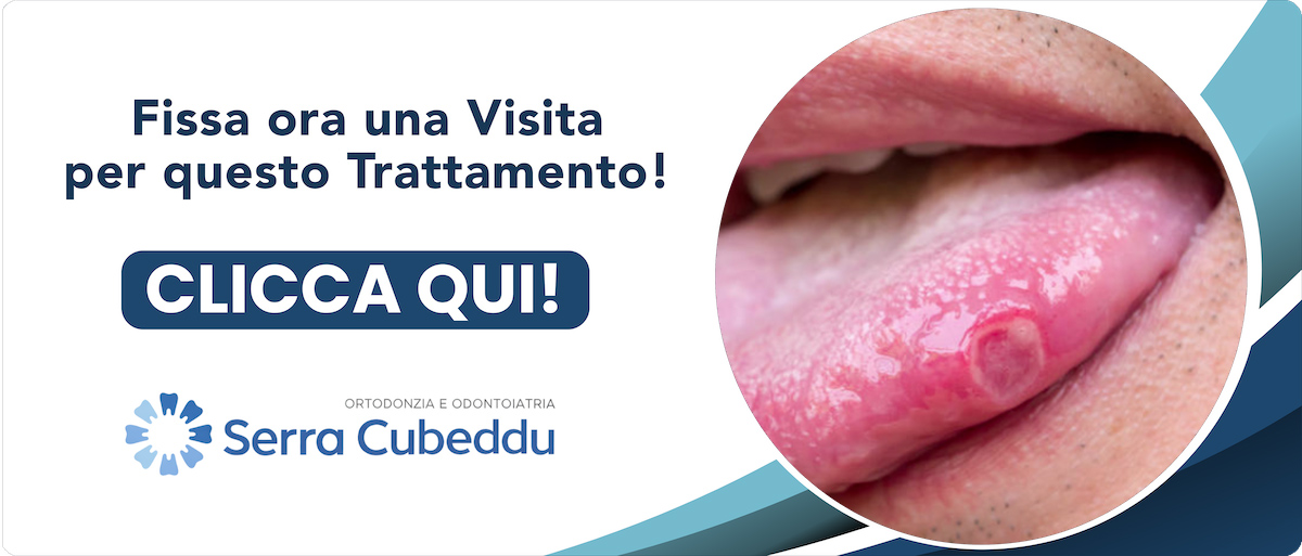 cura-delle-afte-della-bocca Sassari