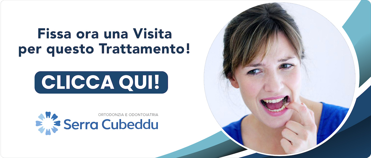 cura-perimplatite Sassari