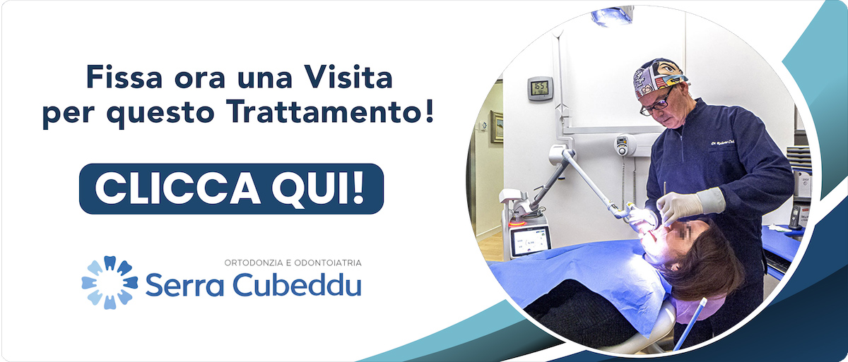 implantologia-carico-immediato Sassari