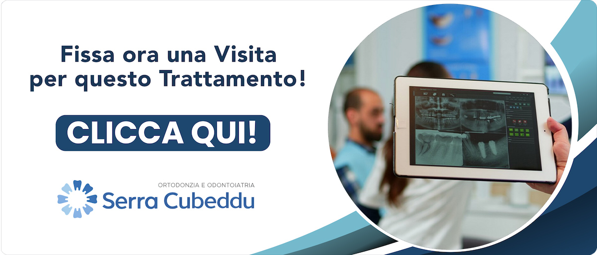 implantologia-computer-guidata Sassari