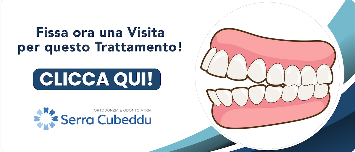 malocclusio-dentali Sassari