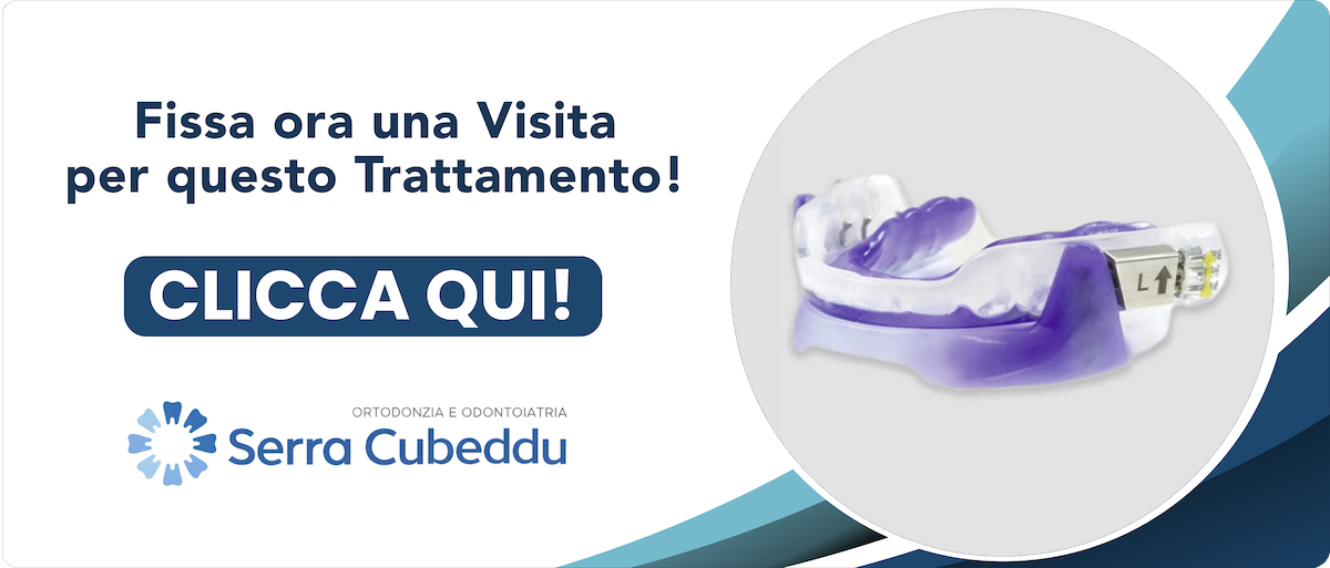ortodonzia-e-apnee-del-sonno Sassari