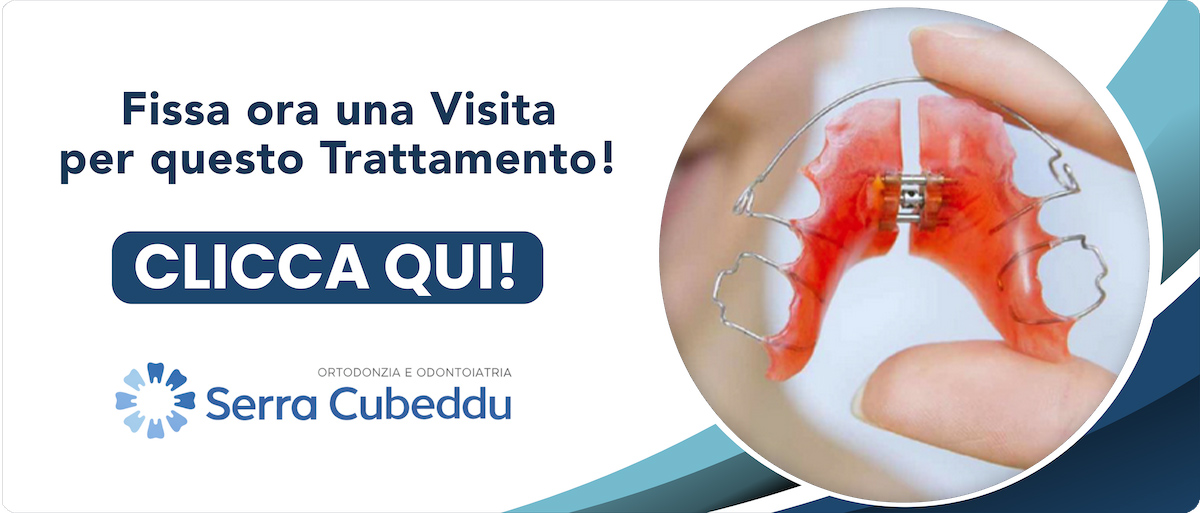 ortodonzia-mobili Sassari