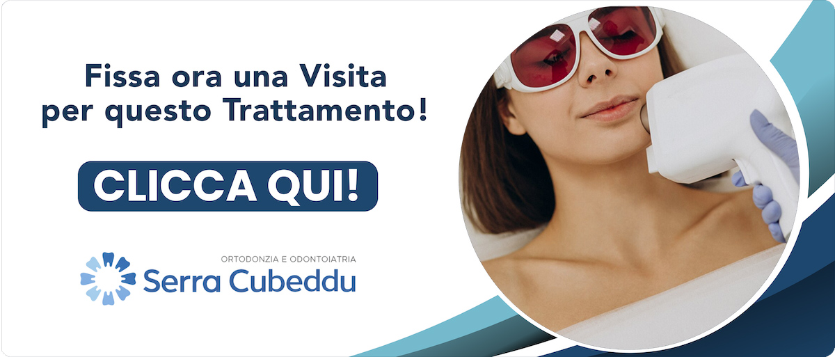 sbiancamento-laser Sassari