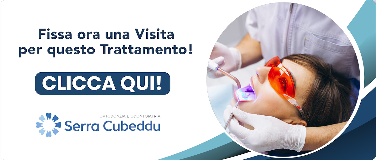 sbiancamento-professionale Sassari